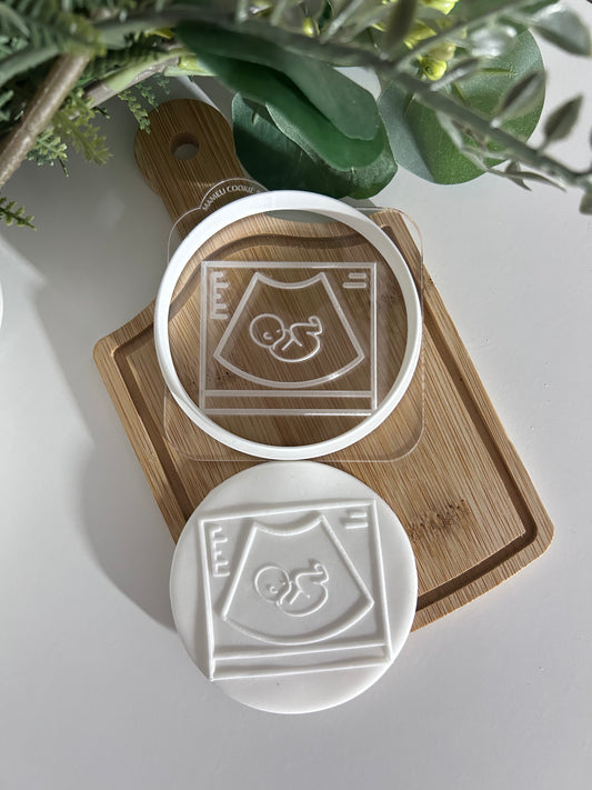 Échographie outbosser